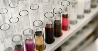Schüßler-Salze Cholesterin: Welche helfen?